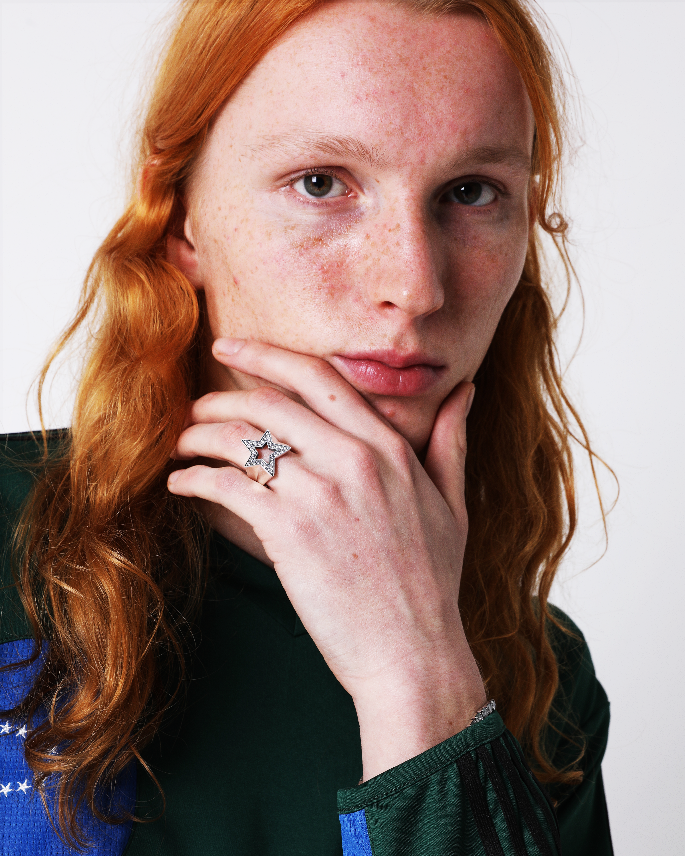 afb リング スター afb リング スター